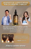 Aceite para Crecimiento de Cabello 100ml | Samantha – Fortalece y estimula desde la raíz
